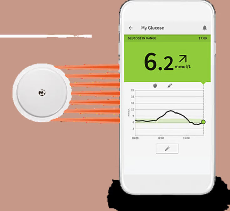 Review Of The Libreview Continuous Blood Glucose Monitoring Device – Worth It?